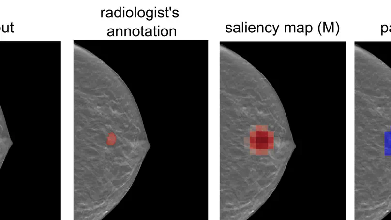 An Efficient Deep Neural Network to Classify Large 3D Images With Small Objects