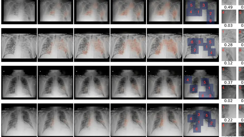 An artificial intelligence system for predicting the deterioration of COVID-19 patients in the emergency department