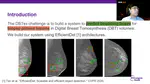 Grand Challenge: Digital Breast Tomosynthesis Lesion Detection